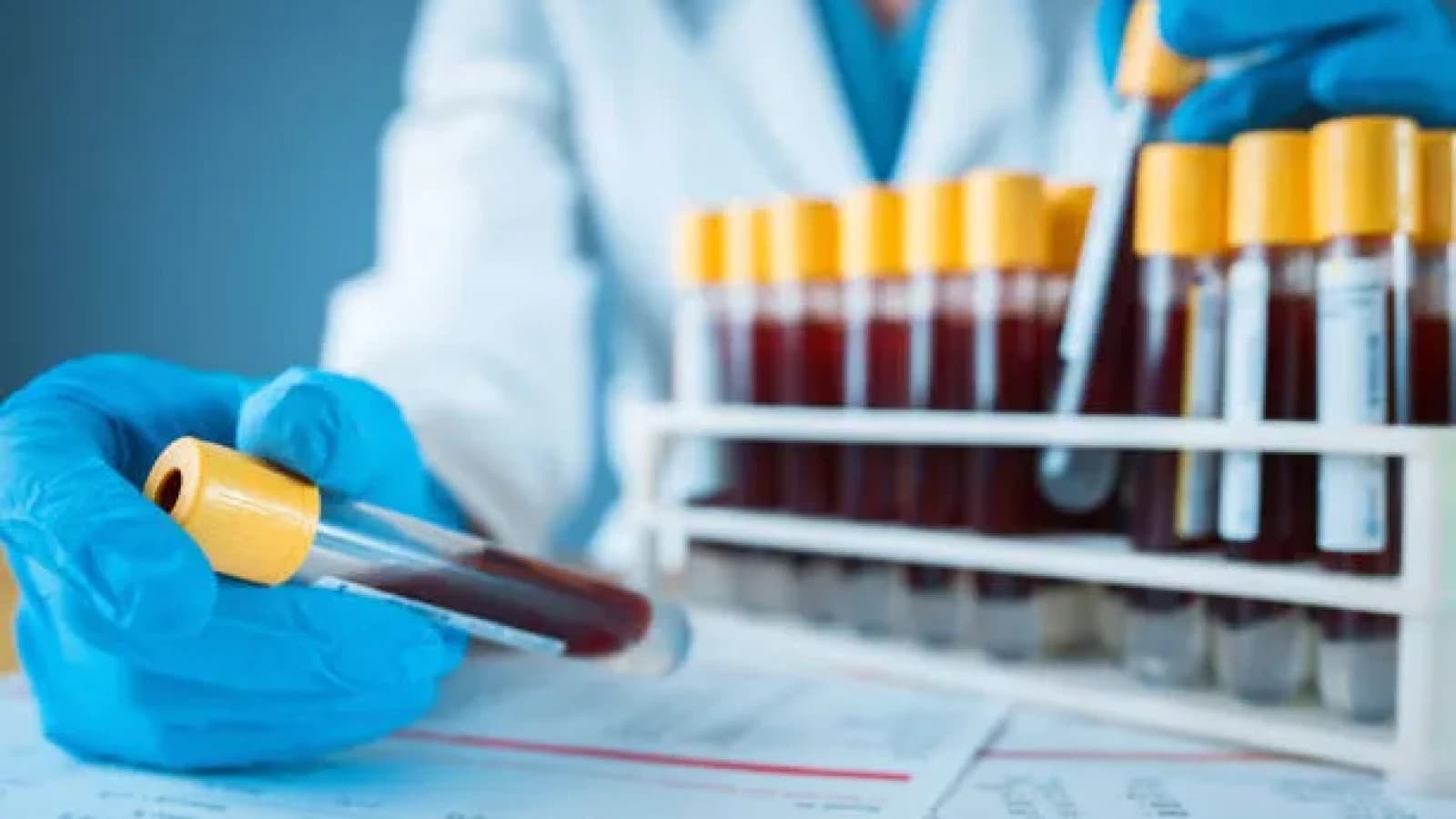 Medicii de la Spitalul 'Sf. Spiridon', apel pentru donarea de sânge; stocurile au ajuns la un nivel critic
